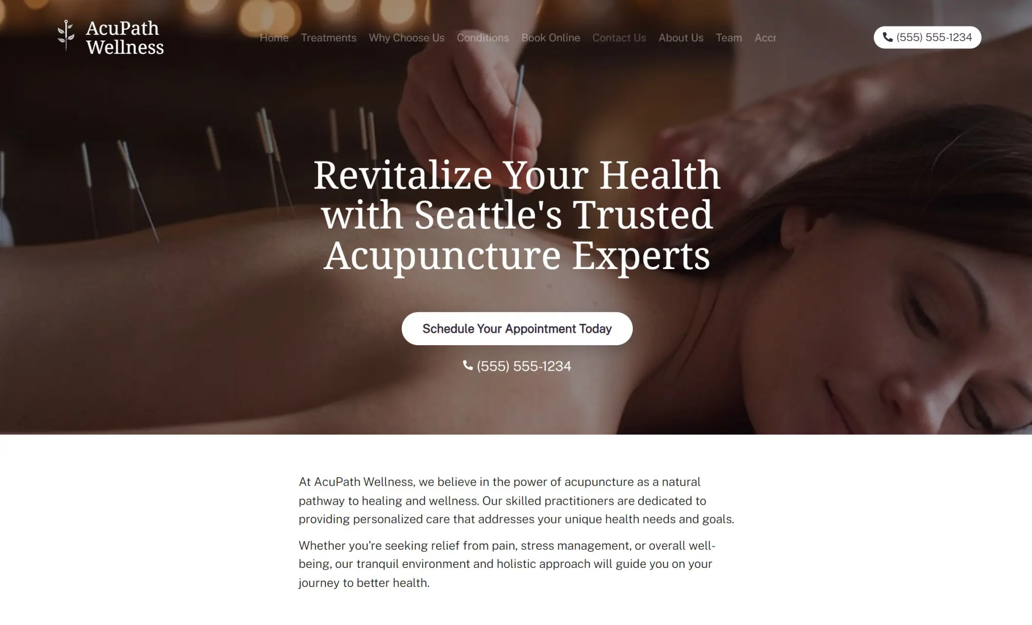 AcuPath Wellness' homepage featuring the image of a woman getting an acupuncture treatment, company branding, call-to-action button, and a brief introduction of the company
