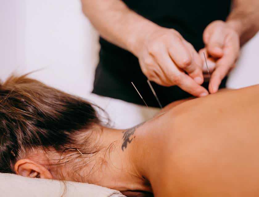 A person inserting acupuncture needles into a woman's back.