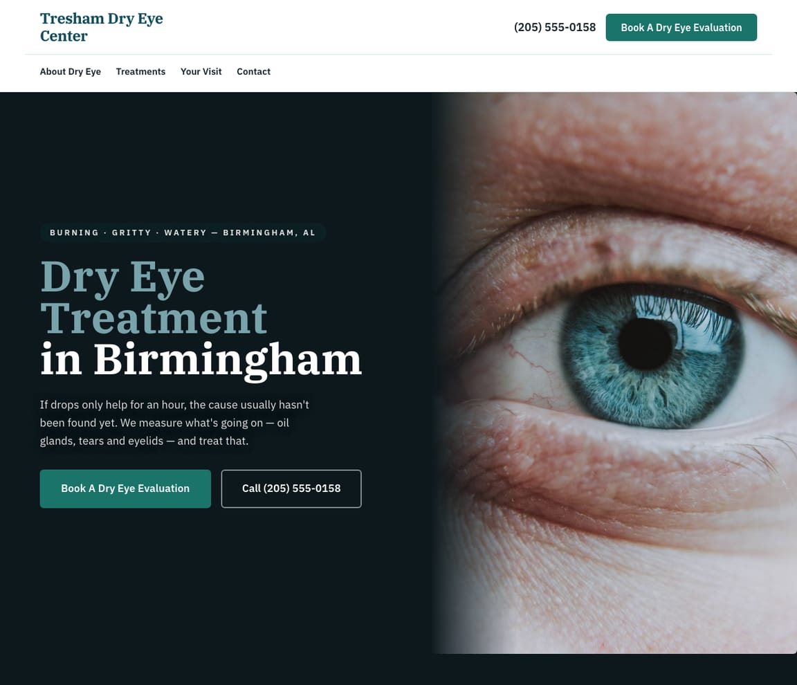 Home page of the Dry Eye Clinic website template, with the headline “Dry Eye Treatment in Birmingham”