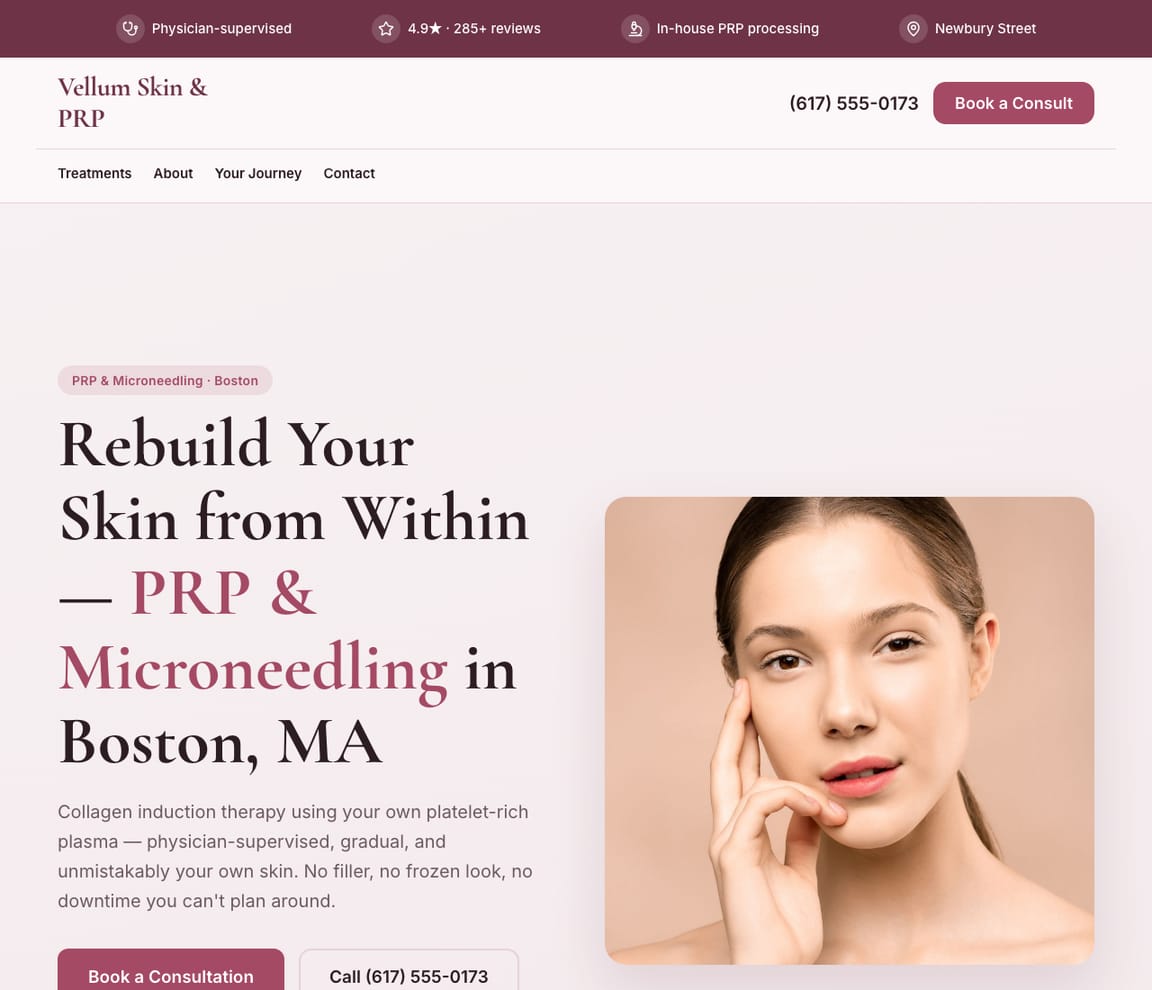 PRP & Microneedling Studio website template preview