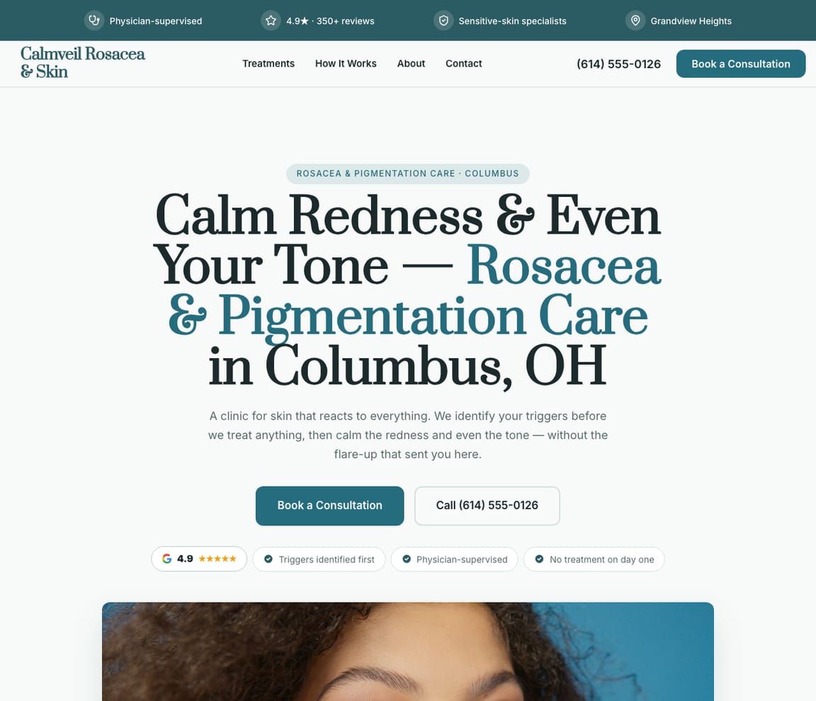 Rosacea & Pigmentation Clinic website template preview
