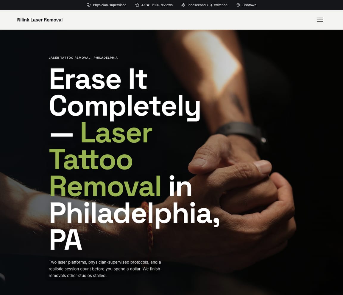 Laser Tattoo Removal Studio website template preview